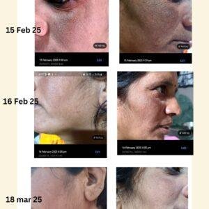 Gleam-R Skin Brightening Cream