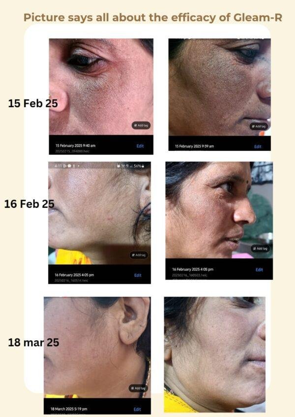Gleam-R Skin Brightening Cream - Image 6